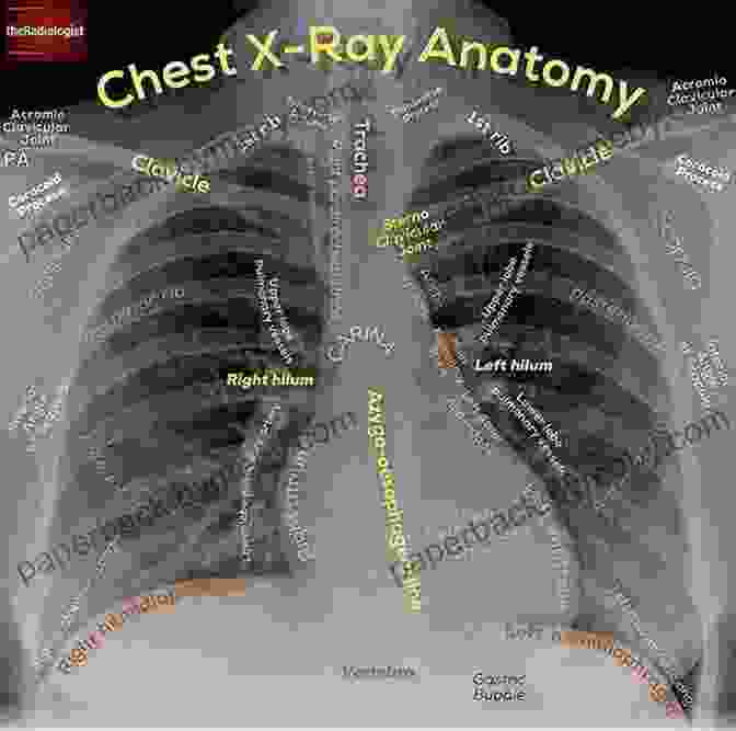 Radiographic Image Of Human Anatomy Mosby S Comprehensive Review Of Radiography E Book: The Complete Study Guide And Career Planner